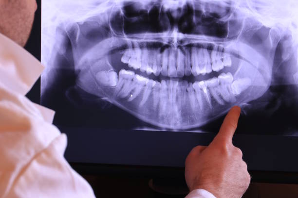 Best Emergency Root Canal Therapy in Port Norris, NJ
