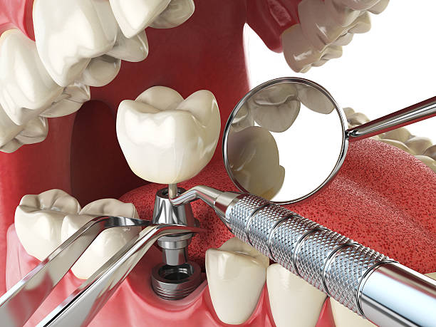 Best Emergency Treatment for Oral Infections in Port Norris, NJ